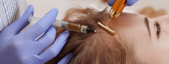 mesoterapia